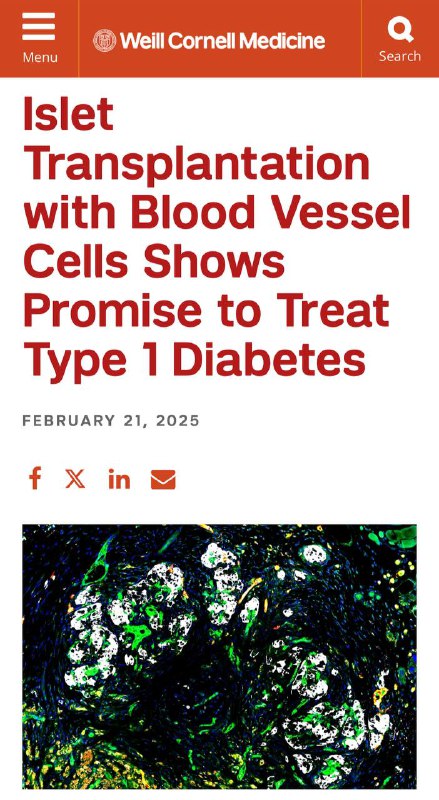 Диабет первого типа ИЗЛЕЧИМ — учёные из Weill Cornell Medicine нашли революционный способ восстанавливать выработку инсулина. Диабет первого типа ИЗЛЕЧИМ — учёные из Weill Cornell Medicine нашли революционный способ восстанавливать выработку инсулина.