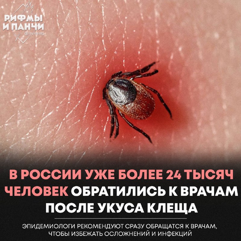 h7khHSZ_5p0djPMjJ0splhE9OyGDjPmx3A3YN3qk0lqXa6H-Lqz0fq4XP9zbkppiMNHtXI-Ci5JTapfX3fKvM_E480zj4VXrh2RTsw8auRrcnuF_PHMaUj5O7-qli_DA9RLGR2C403pCpwFmsxxqg0bdjVOUI7Jb8fOXi6B0We6FMPBwmNRquhAdsXedX2G4uRk9cgxpFOUrWL1KzrIgBkvmzUeyATngzRuwy9eH1Pdu7wtKFUYeTUqfcT7PjpEDMP83VTOi91WLjmMY03ZAdSk7o1_79B_Aev_eEzyijK-RwxIDwCEKSxpUSNPyhdde48BOiEUTGicDOhHt1K9TdA.jpg