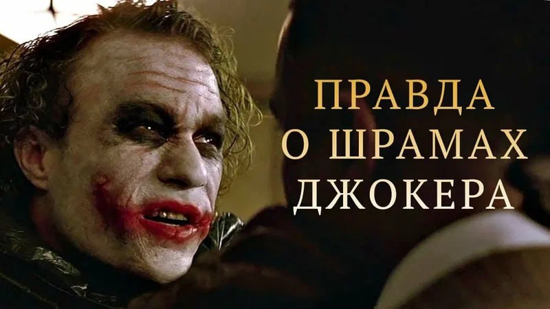 Москвич порвал себе рот ШАУРМОЙ — бедолага был сильно... Москвич порвал себе рот ШАУРМОЙ — бедолага был сильно...